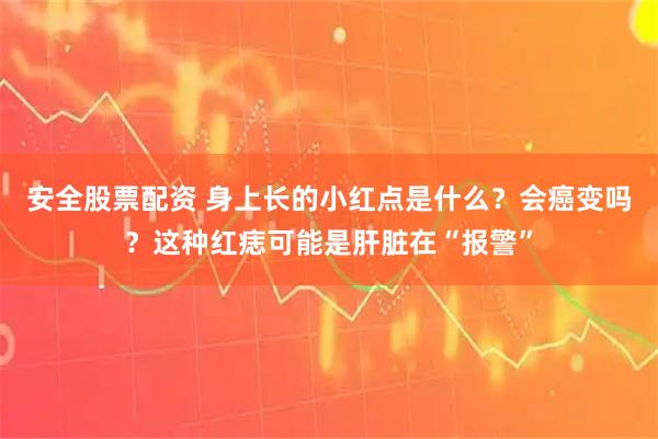 安全股票配资 身上长的小红点是什么？会癌变吗？这种红痣可能是肝脏在“报警”